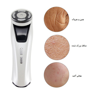 دستگاه مینی هایفو او ای ام مدل The Maea - 05