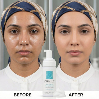 فوم شسـتشوی صورت مدل Balancing مناسب پوســت چرب و دارای آکنه حجم 150 میلی لیتر اورموس - 06