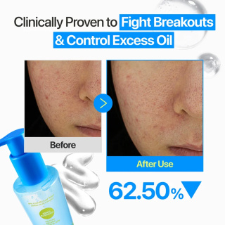 ژل پاک کننده میسلار فاقد چربی مدل Zero Blemish مناسب پوست مستعد جوش حجم 200 میلی لیتر نامبوزین - 03