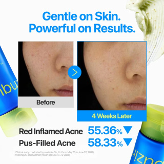 فوم شوینده و شفاف کننده صورت مدل Zero Blemish حاوی 2٪ گوگرد مناسب پوست مستعد جوش حجم 150 میلی لیتر نامبوزین - 04